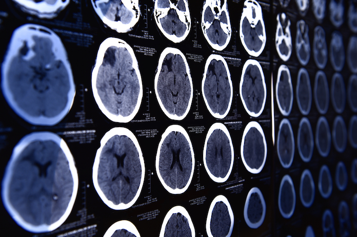 180817 b2b - article - dr. kee park on neurosurgery b
